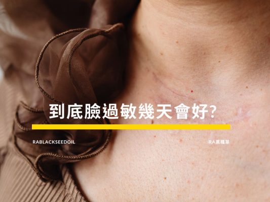 臉過敏幾天會好