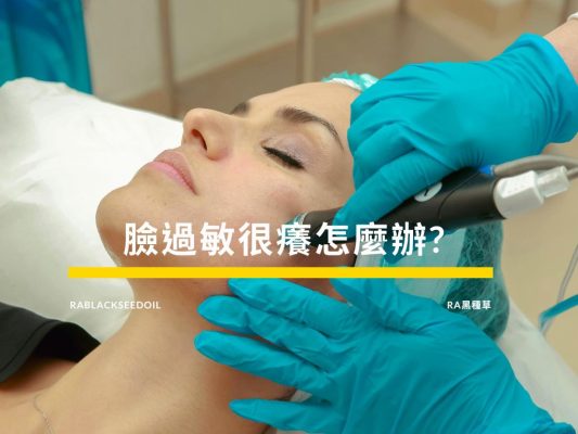 臉過敏很癢怎麼辦