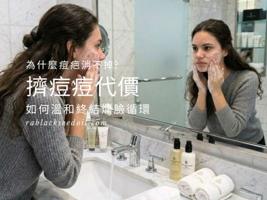 擠痘痘問題改善