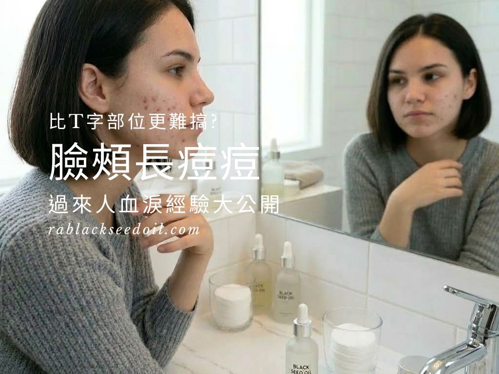 為什麼臉頰長痘痘比 T 字部位更難搞？避開 5 個讓你反覆長痘的保養誤區，過來人血淚經驗大公開