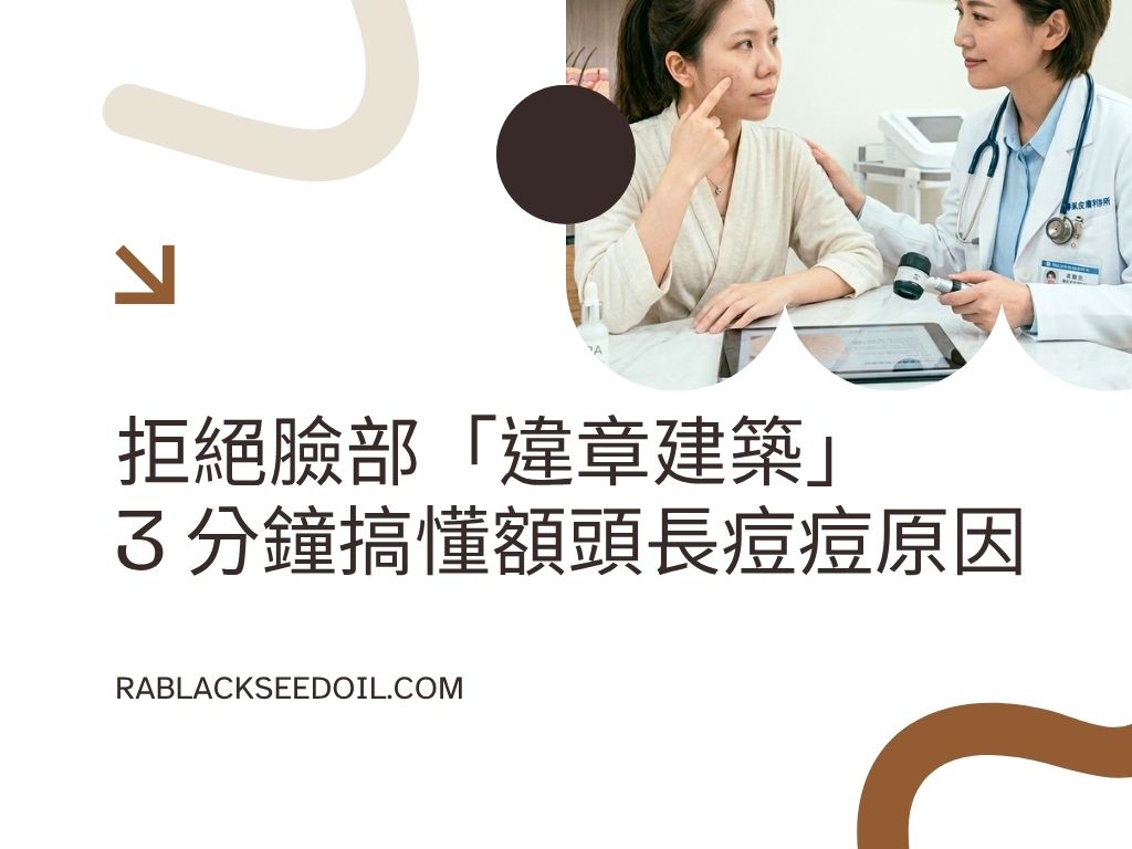 額頭長痘痘原因